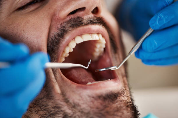Best Emergency Tooth Extraction in Kahaluu Keauhou, HI